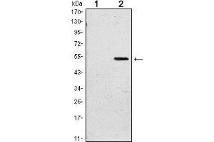 Western blot analysis using SUZ12 mAb against HEK293 (1) and SUZ12(AA: 533-739)-hIgGFc transfected HEK293 (2) cell lysate. (SUZ12 抗体)