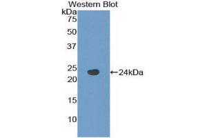 Western Blotting (WB) image for anti-Tachykinin Receptor 2 (TACR2) (AA 92-290) antibody (ABIN1860673) (TACR2 抗体  (AA 92-290))