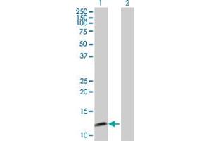 Western Blot analysis of SYCN expression in transfected 293T cell line by SYCN MaxPab polyclonal antibody. (SYCN 抗体  (AA 1-134))