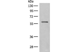 Western blot analysis of Mouse eye tissue lysate using SLC5A1 Polyclonal Antibody at dilution of 1:500 (SLC5A1 抗体)