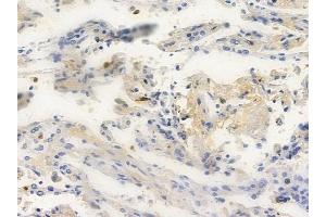 anti-Golgi Transport 1A (GOLT1A) (Internal Region) antibody