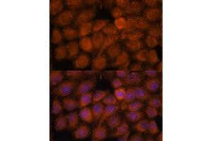 Immunofluorescence (IF) image for anti-NADH Dehydrogenase (Ubiquinone) 1 alpha Subcomplex, Assembly Factor 4 (NDUFAF4) (AA 1-170) antibody (ABIN7268807)