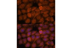 Immunofluorescence analysis of HeLa cells using NDUF antibody (ABIN7268807) at dilution of 1:100. (NDUFAF4 抗体  (AA 1-170))