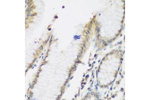 Immunohistochemistry of paraffin-embedded human stomach using NAA50 antibody at dilution of 1:200 (40x lens). (NAA50 抗体)