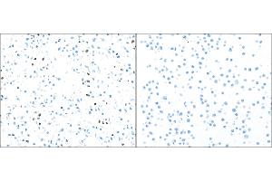 Immunocytochemistry (ICC) image for anti-Poly (ADP-Ribose) Polymerase 1 (PARP1) (AA 215-265) antibody (ABIN7455116) (Recombinant PARP1 抗体  (AA 215-265))