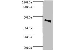 Western blot All lanes: CBX8 antibody at 2 μg/mL + Jurkat whole cell lysate Secondary Goat polyclonal to rabbit IgG at 1/10000 dilution Predicted band size: 43 kDa Observed band size: 43 kDa (CBX8 抗体  (AA 80-280))
