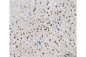 IHC analysis of CHD1 using anti-CHD1 antibody (ABIN7602361).