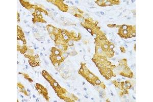 Immunohistochemistry (Paraffin-embedded Sections) (IHC (p)) image for anti-Cytochrome P450, Family 2, Subfamily E, Polypeptide 1 (CYP2E1) antibody (ABIN7260247)