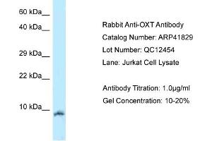 Host:  Rabbit  Target Name:  OXT  Sample Tissue:  Human Jurkat  Antibody Dilution:  1ug/ml (OXT 抗体  (N-Term))