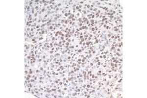 Immunohistochemistry (IHC) image for anti-Achaete-Scute Complex Homolog 2 (ASCL2) (AA 225-275) antibody (ABIN7454590)
