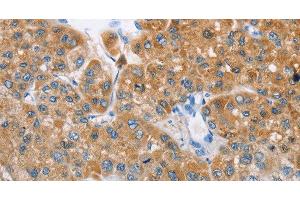 Immunohistochemistry (Paraffin-embedded Sections) (IHC (p)) image for anti-3-hydroxybutyrate Dehydrogenase, Type 1 (BDH1) antibody (ABIN7240898)