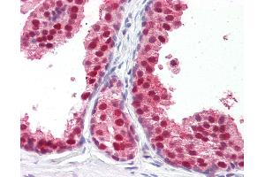 Anti-RXRB antibody IHC of human prostate. (Retinoid X Receptor beta 抗体  (Hinge Region))