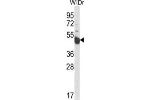 Western Blotting (WB) image for anti-Inscuteable Homolog (INSC) antibody (ABIN3004284) (INSC 抗体)