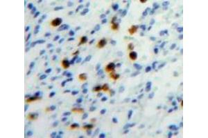 Used in DAB staining on fromalin fixed paraffin-embedded Spleen tissue (HAT1 抗体  (AA 100-338))