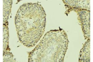 ABIN6274741 at 1/100 staining Mouse testis tissue by IHC-P. (MRPL41 抗体  (C-Term))