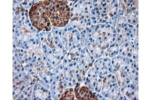 Immunohistochemical staining of paraffin-embedded liver tissue using anti-HSP90AA1mouse monoclonal antibody. (HSP90AA1 抗体)