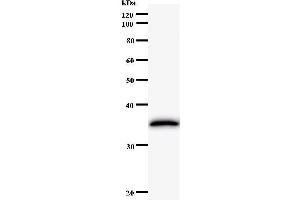 Western Blotting (WB) image for anti-Excision Repair Cross-Complementing Rodent Repair Deficiency, Complementation Group 8 (ERCC8) antibody (ABIN931164) (ERCC8 抗体)