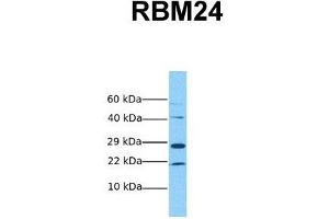 Host:  Rabbit  Target Name:  RBM24  Sample Tissue:  Human MCF7  Antibody Dilution:  1. (RBM24 抗体  (Middle Region))