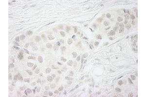 Immunohistochemistry (IHC) image for anti-Budding Uninhibited By Benzimidazoles 1 Homolog beta (Yeast) (BUB1B) (AA 1-50) antibody (ABIN7448450) (BUB1B 抗体  (AA 1-50))