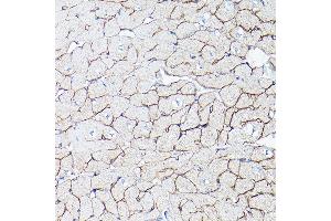 Immunohistochemistry (IHC) image for anti-Dystrophin (DMD) (AA 346-635) antibody (ABIN1679546)