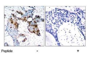 Image no. 1 for anti-Estrogen Receptor 1 (ESR1) (Ser118) antibody (ABIN197218)