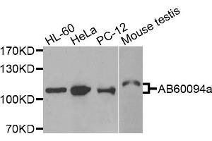 Western blot analysis of extracts of various cells, using ADAMTS5 antibody. (ADAMTS5 抗体)