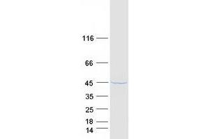 Western Blotting (WB) image for Guanosine Monophosphate Reductase 2 (GMPR2) (Transcript Variant 1) protein (Myc-DYKDDDDK Tag) (ABIN2722089)
