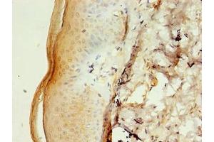 Immunohistochemistry of paraffin-embedded human skin tissue using ABIN7146503 at dilution of 1:100 (CALML5 抗体  (AA 2-146))