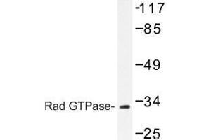 Image no. 1 for anti-RAS (RAD and GEM)-Like GTP-Binding 1 (REM1) antibody (ABIN317842) (REM1 抗体)