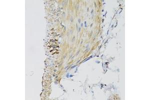 Immunohistochemistry of paraffin-embedded mouse stomach using DGUOK antibody (ABIN2562205) at dilution of 1:100 (40x lens). (Deoxyguanosine Kinase 抗体)