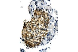 Formalin-fixed and paraffin embedded rat pancreas tissue labeled with Anti-IL-6 Polyclonal Antibody, Unconjugated (ABIN739385) followed by conjugation to the secondary antibody and DAB staining