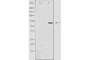 Western blot analysis of extracts from 293 cells, using TIGD1 antibody. (TIGD1 抗体  (Internal Region))