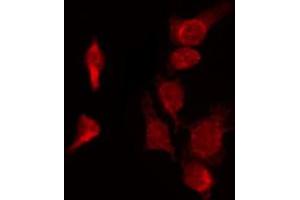 Immunofluorescence (fixed cells) (IF/ICC) image for anti-NIMA (Never in Mitosis Gene A)- Related Kinase 9 (NEK9) (Internal Region) antibody (ABIN6263595)
