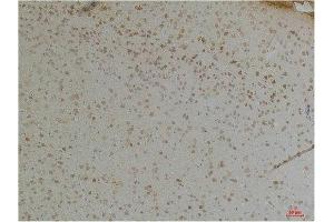 Immunohistochemistry (IHC) analysis of paraffin-embedded Mouse Brain Tissue using KChIP1 Rabbit Polyclonal Antibody diluted at 1:200. (KCNIP1 抗体)