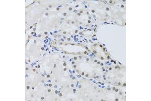 Immunohistochemistry of paraffin-embedded mouse kidney using PRPF19 antibody. (PRP19 抗体)