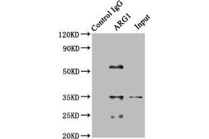 Immunoprecipitating SOD1 in HEK293 whole cell lysate Lane 1: Rabbit control IgG (1 μg) instead of ABIN7144580 in HEK293 whole cell lysate. (Liver Arginase 抗体  (AA 1-322))