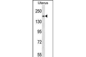 SMC1B Antibody (Center) (ABIN657773 and ABIN2846748) western blot analysis in human normal Uterus tissue lysates (35 μg/lane).