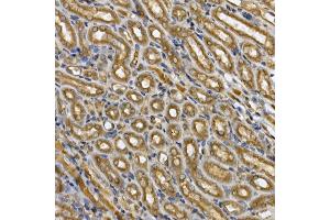 Immunohistochemistry (IHC) image for anti-Signal Transducer and Activator of Transcription 3 (Acute-Phase Response Factor) (STAT3) (AA 640-770) antibody (ABIN6148568)