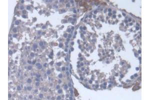 DAB staining on IHC-P; Samples: Mouse Testis Tissue (CYP17A1 抗体  (AA 201-507))