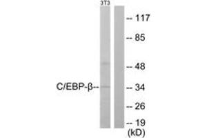 Western blot analysis of extracts from NIH-3T3 cells, using C/EBP-beta (Ab-235/188) Antibody. (CEBPB 抗体  (AA 201-250))
