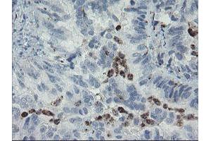 Image no. 2 for anti-Myosin Light Chain 7, Regulatory (MYL7) antibody (ABIN1499491) (MYL7 抗体)