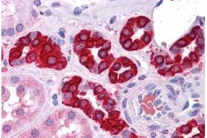 Human Kidney: Formalin-Fixed, Paraffin-Embedded (FFPE) (AGR3 抗体)