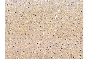 ABIN7094717 and ABIN7098768 at 1/100 staining Mouse brain tissue by IHC-P.