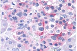 Anti-TRPV4 antibody  ABIN1049441 IHC staining of human pancreas, islet. (TRPV4 抗体  (Internal Region))