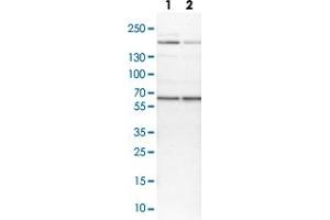 Western blot analysis of Lane 1: NIH-3T3 cell lysate (Mouse embryonic fibroblast cells) Lane 2: NBT-II cell lysate (Rat Wistar bladder tumour cells) with USP14 polyclonal antibody  at 1:100-1:250 dilution. (USP14 抗体)