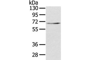 Western Blotting (WB) image for anti-Transducin (Beta)-Like 1X-Linked (TBL1X) antibody (ABIN5961943) (TBL1X 抗体)
