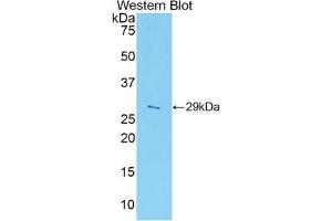 Western blot analysis of the recombinant protein. (ADAM5 抗体  (AA 413-649))