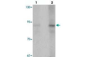 Western blot analysis of AFAP1 in HeLa cell lysate with AFAP1 polyclonal antibody  at (lane 1) 1 and (lane 2) 2 ug/mL. (AFAP 抗体  (N-Term))