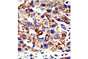 Image no. 1 for anti-Histone Deacetylase 8 (HDAC8) (N-Term) antibody (ABIN356653) (HDAC8 抗体  (N-Term))