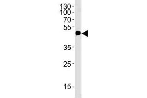 Western blot analysis of lysate from 12-Tag protein using c-Myc antibody; Ab was diluted at 1:4000. (Myc Tag 抗体  (AA 408-439))